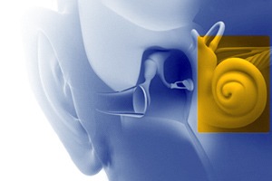 Sensorineural Hearing Loss