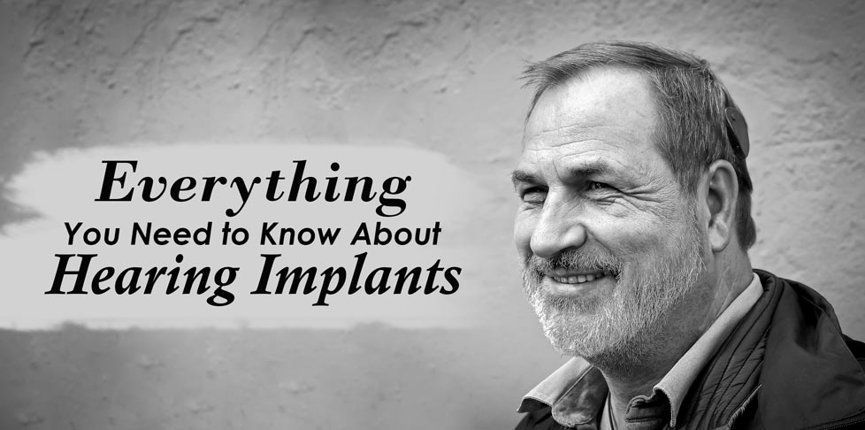Everything You Need to Know About Hearing Implants